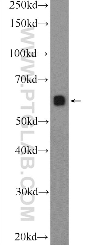 Western Blot (WB) analysis of COLO 320 cells using c-SRC Polyclonal antibody (25978-1-AP)