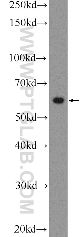 Western Blot (WB) analysis of A431 cells using c-SRC Polyclonal antibody (25978-1-AP)