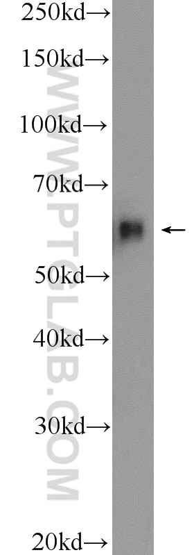 Western Blot (WB) analysis of mouse brain tissue using c-SRC Polyclonal antibody (25978-1-AP)
