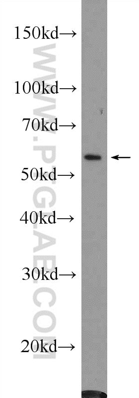 Western Blot (WB) analysis of CHO cells using c-SRC Polyclonal antibody (25978-1-AP)
