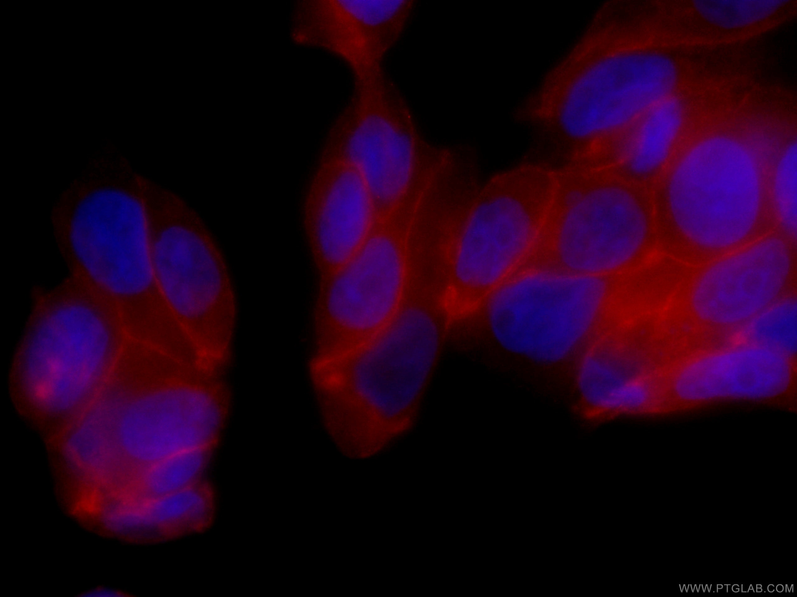 Immunofluorescence (IF) / fluorescent staining of MCF-7 cells using CoraLite®594-conjugated c-SRC Monoclonal antibody (CL594-60315)