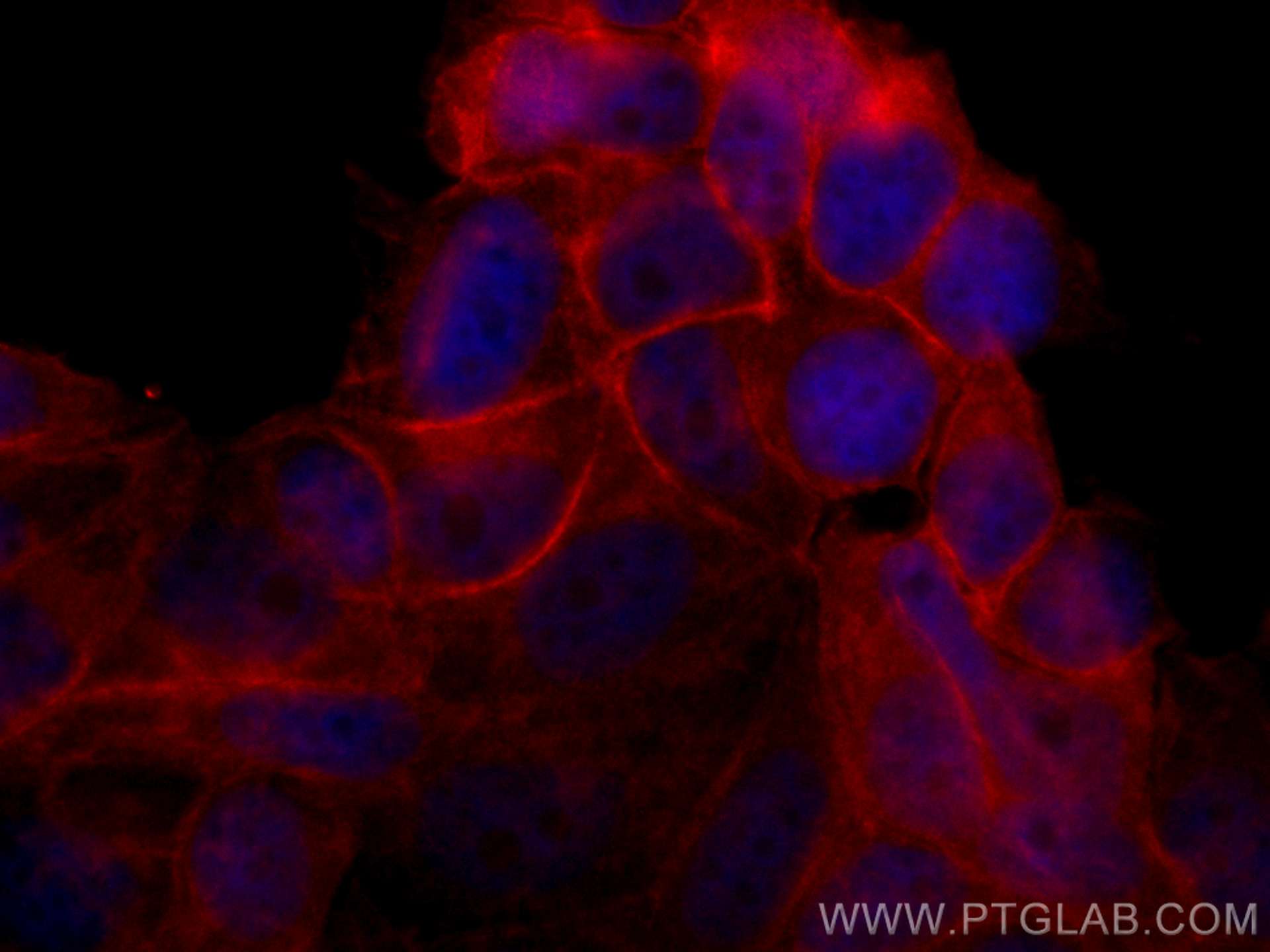 Immunofluorescence (IF) / fluorescent staining of MCF-7 cells using CoraLite®594-conjugated c-SRC Monoclonal antibody (CL594-60315)