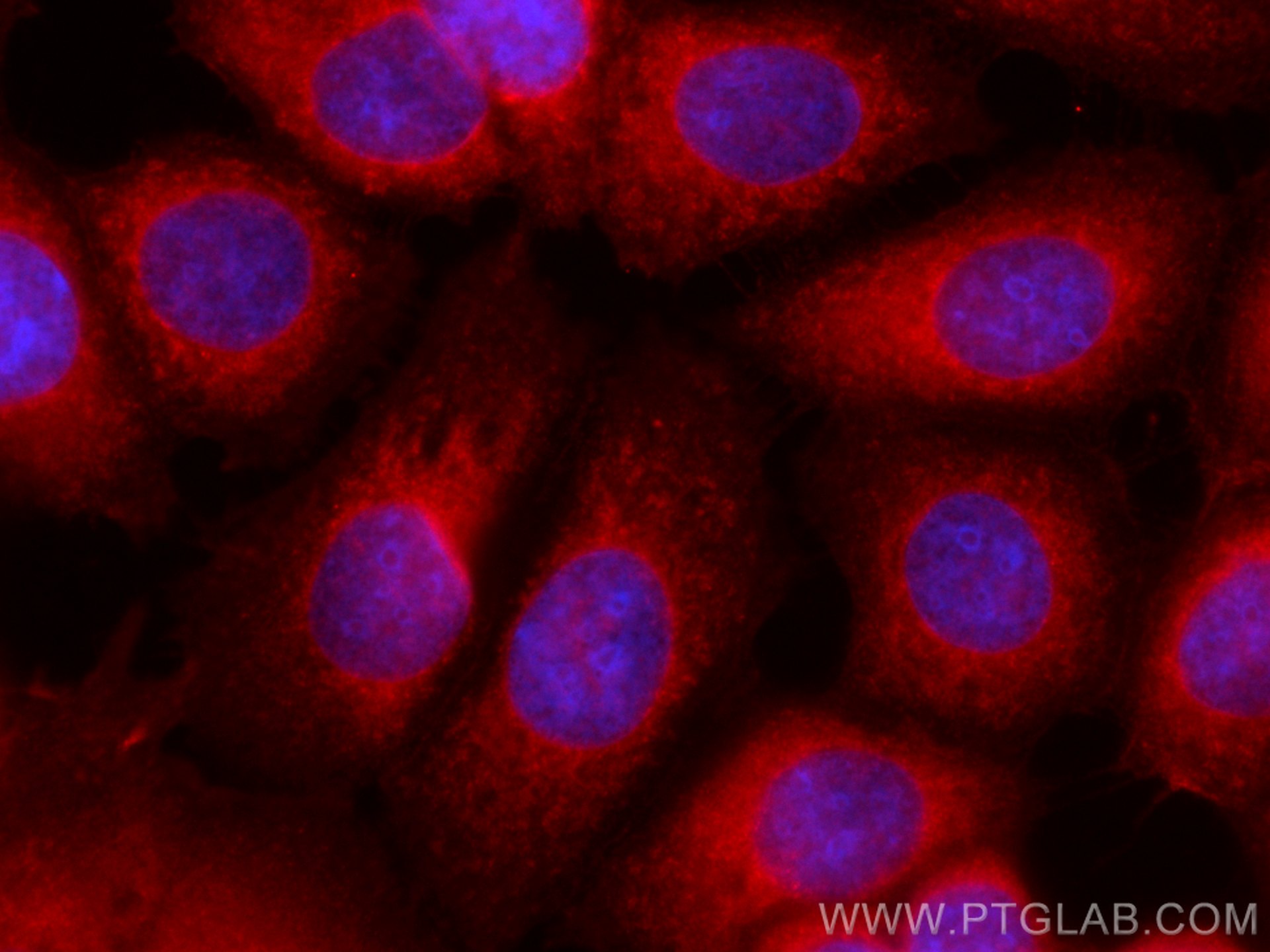 Immunofluorescence (IF) / fluorescent staining of MCF-7 cells using CoraLite®594-conjugated c-SRC Monoclonal antibody (CL594-60315)