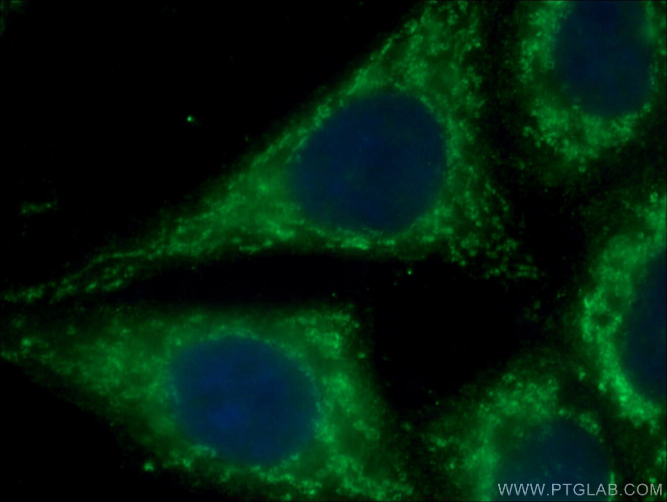 Immunofluorescence (IF) / fluorescent staining of HepG2 cells using cIAP1 Monoclonal antibody (66626-1-Ig)
