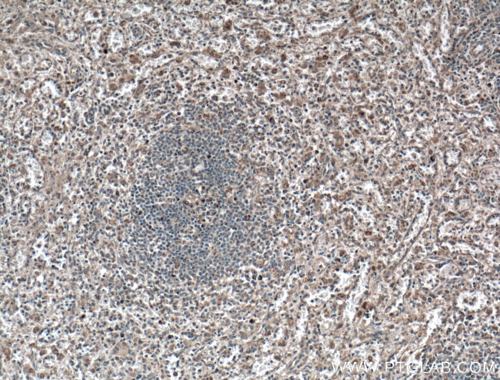 IHC staining of human spleen using 66626-1-Ig