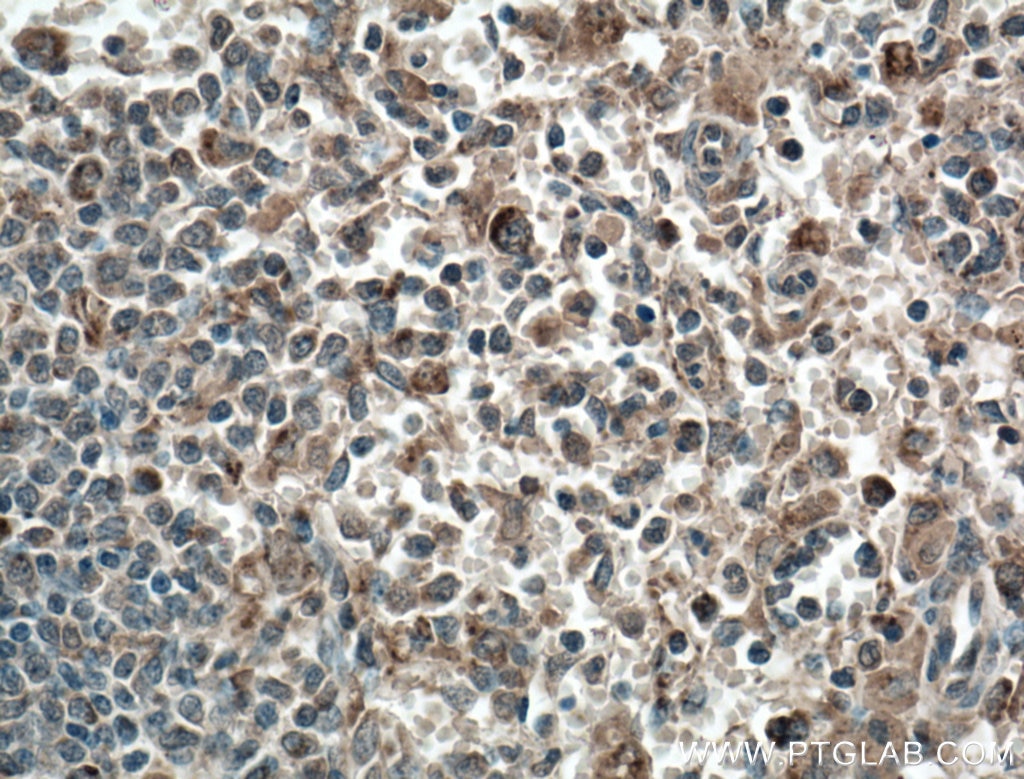Immunohistochemistry (IHC) staining of human spleen tissue using cIAP1 Monoclonal antibody (66626-1-Ig)