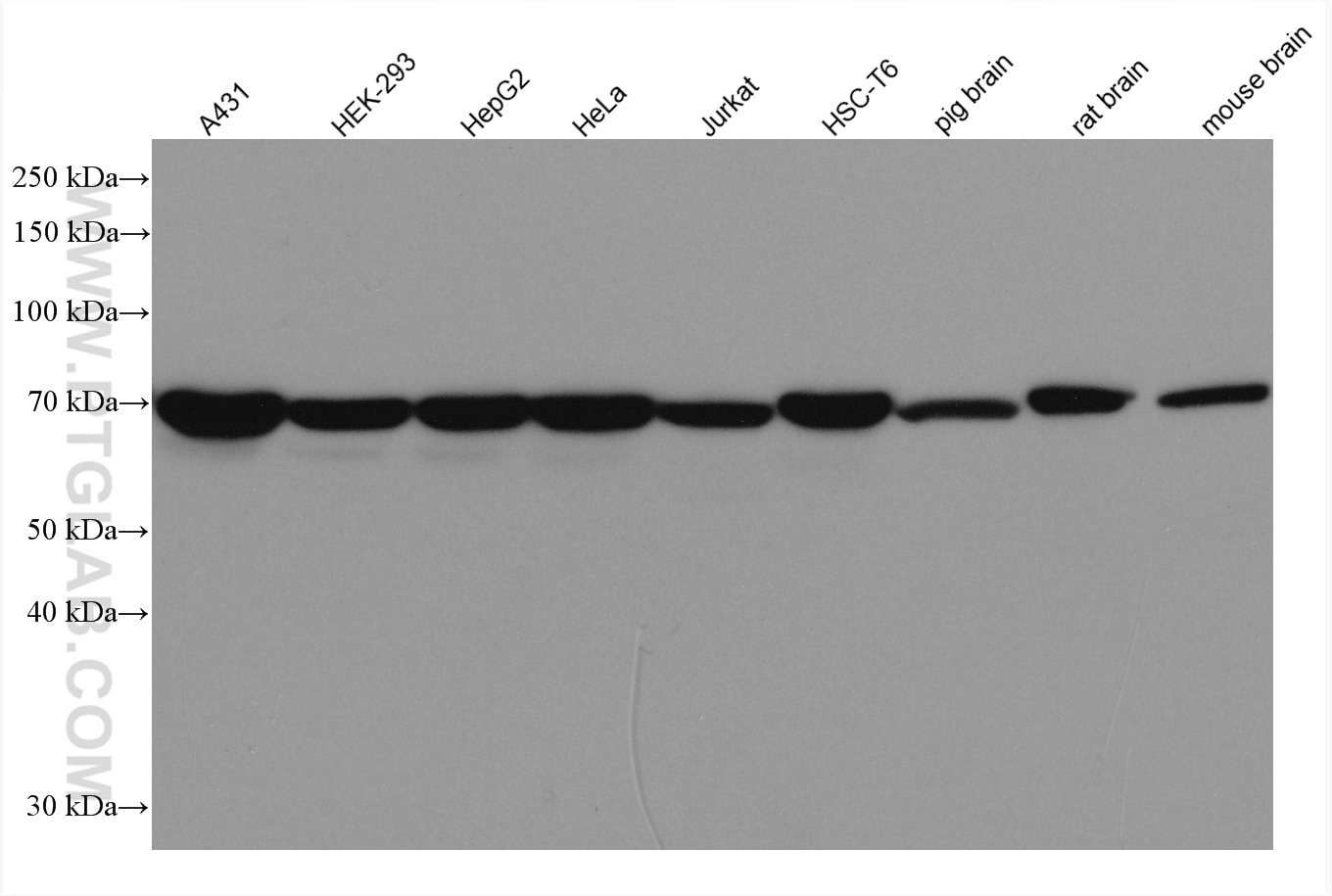 Western Blot (WB) analysis of various lysates using cIAP1 Monoclonal antibody (66626-1-Ig)