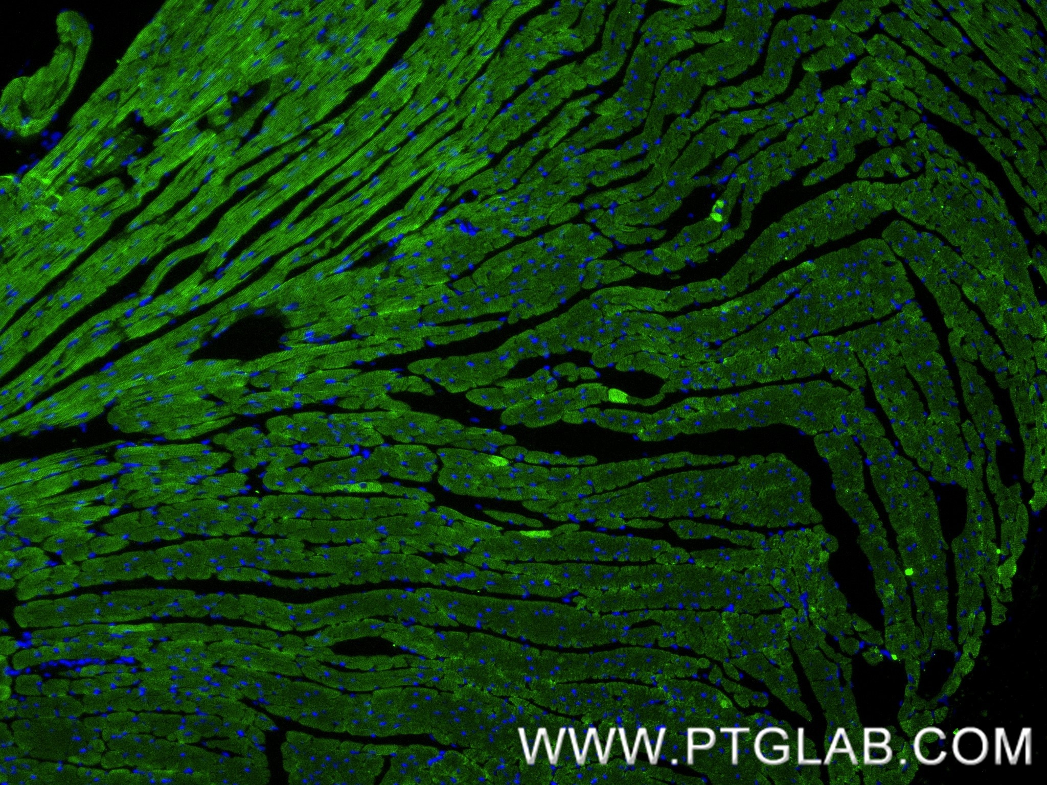 Immunofluorescence (IF) / fluorescent staining of mouse heart tissue using cTnT Recombinant antibody (81638-3-RR)