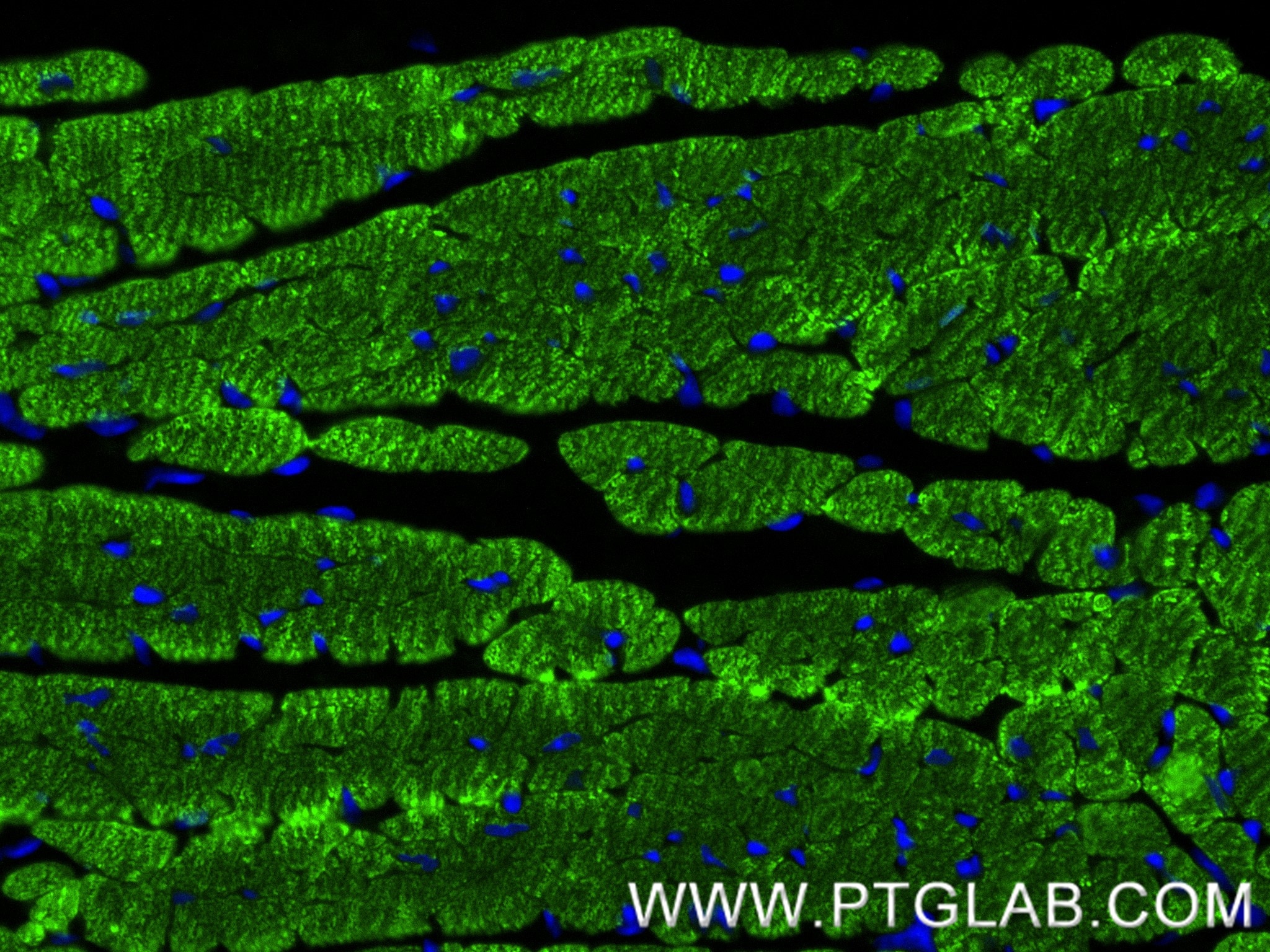 Immunofluorescence (IF) / fluorescent staining of mouse heart tissue using cTnT Recombinant antibody (81638-3-RR)