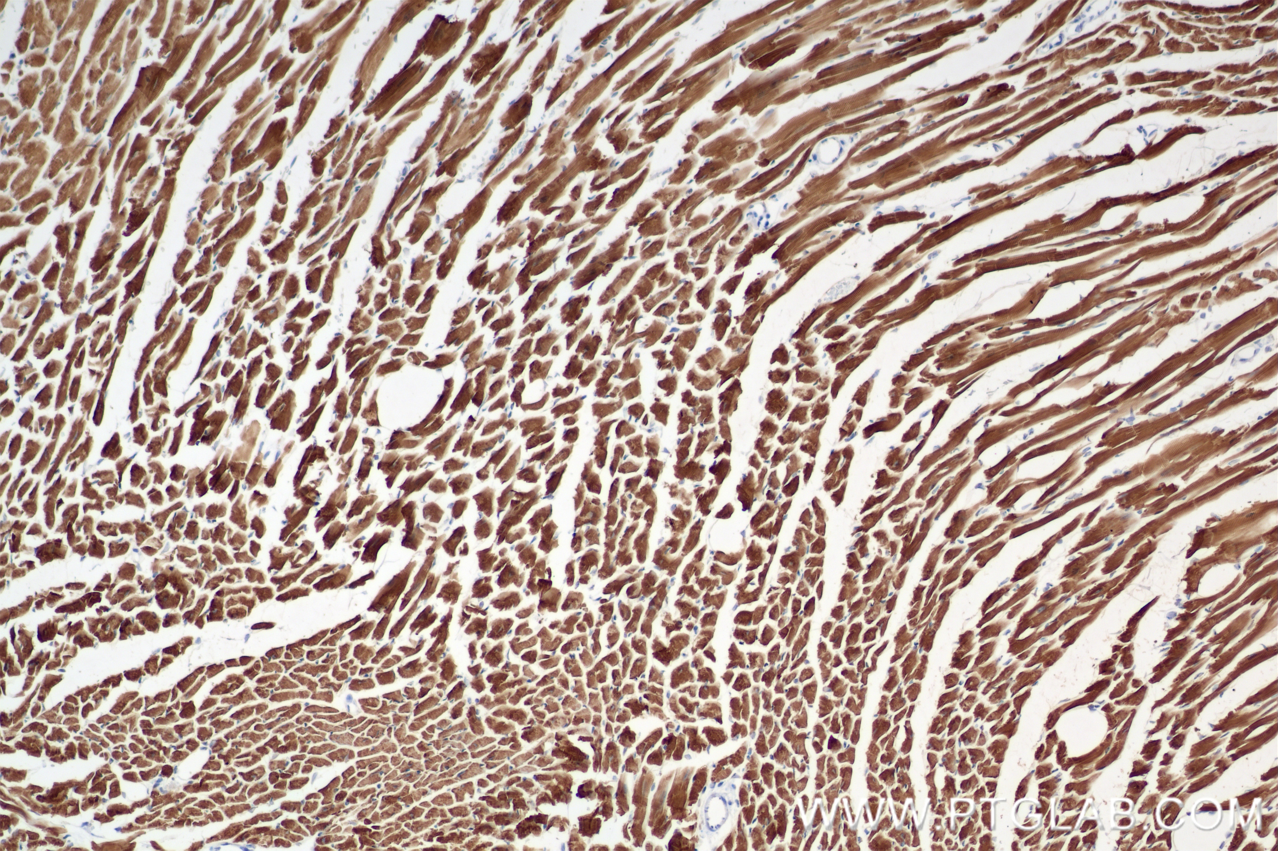 Immunohistochemistry (IHC) staining of mouse heart tissue using cTnT Recombinant antibody (81638-3-RR)