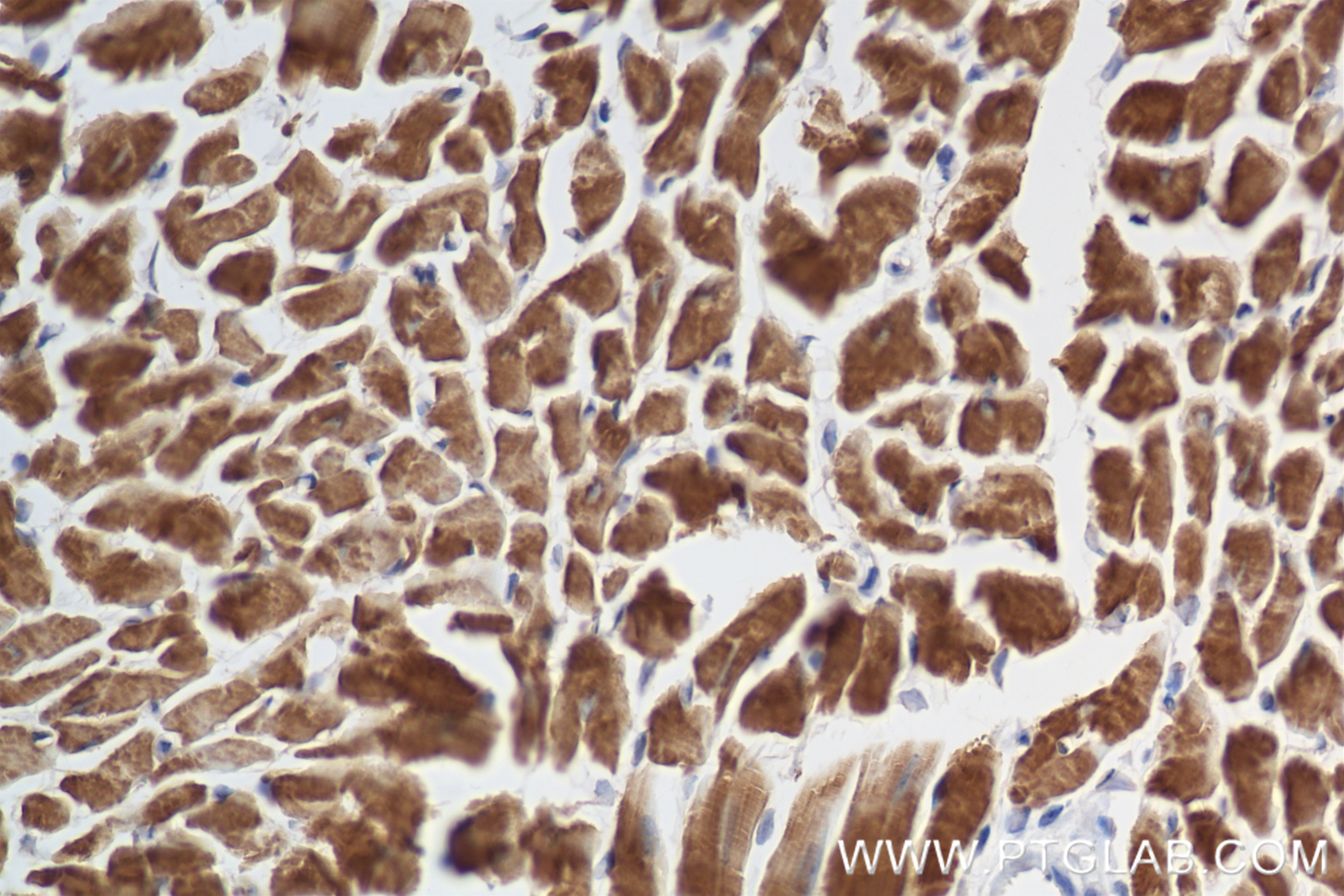 Immunohistochemistry (IHC) staining of mouse heart tissue using cTnT Recombinant antibody (81638-3-RR)