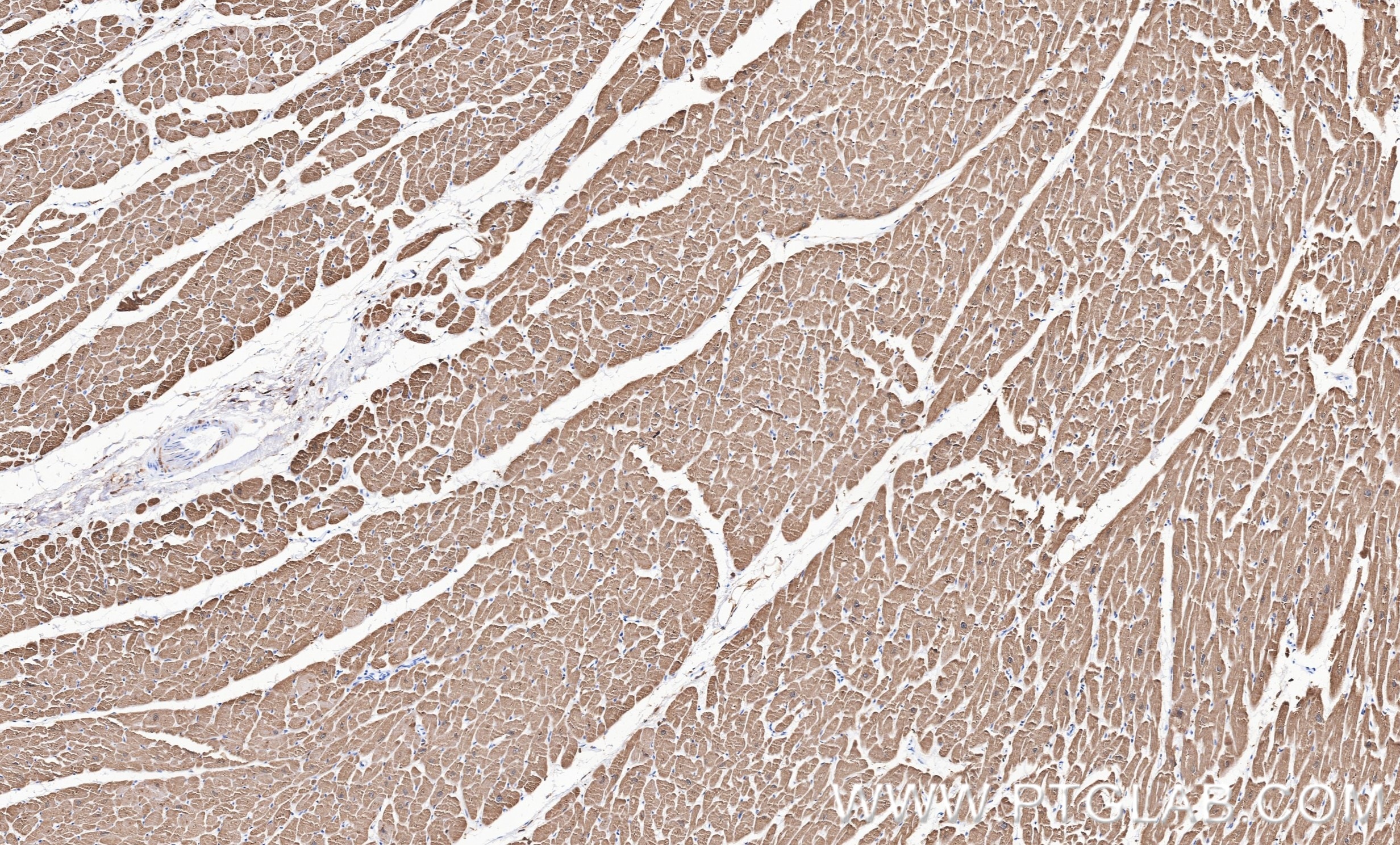 IHC staining of human heart using 81638-3-RR Immunohistochemistry (IHC) staining of human heart tissue using Cardiac Troponin T Recombinant monoclonal antibody (81638-3-RR)