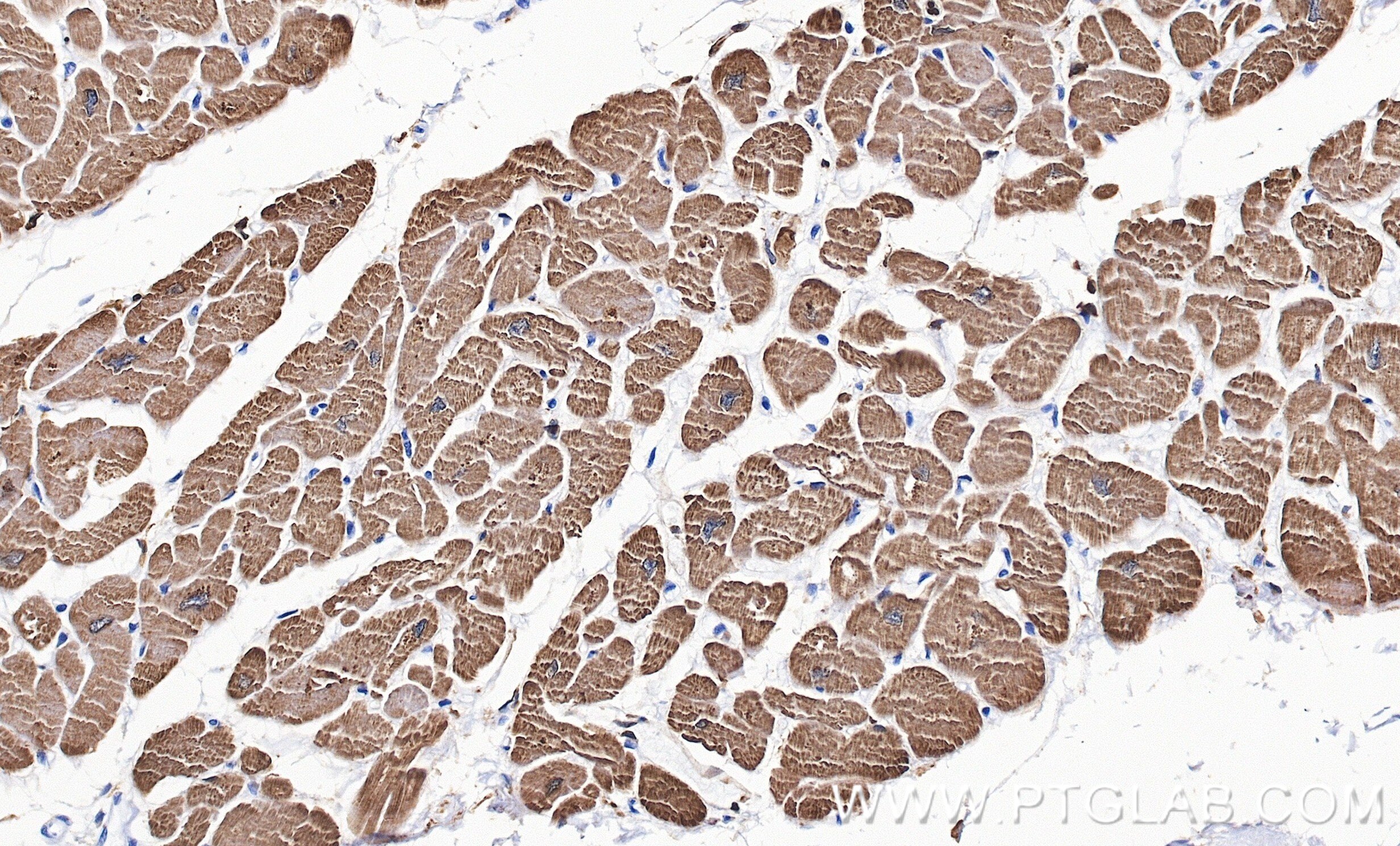 IHC staining of human heart using 81638-3-RR Immunohistochemistry (IHC) staining of human heart tissue using Cardiac Troponin T Recombinant monoclonal antibody (81638-3-RR)