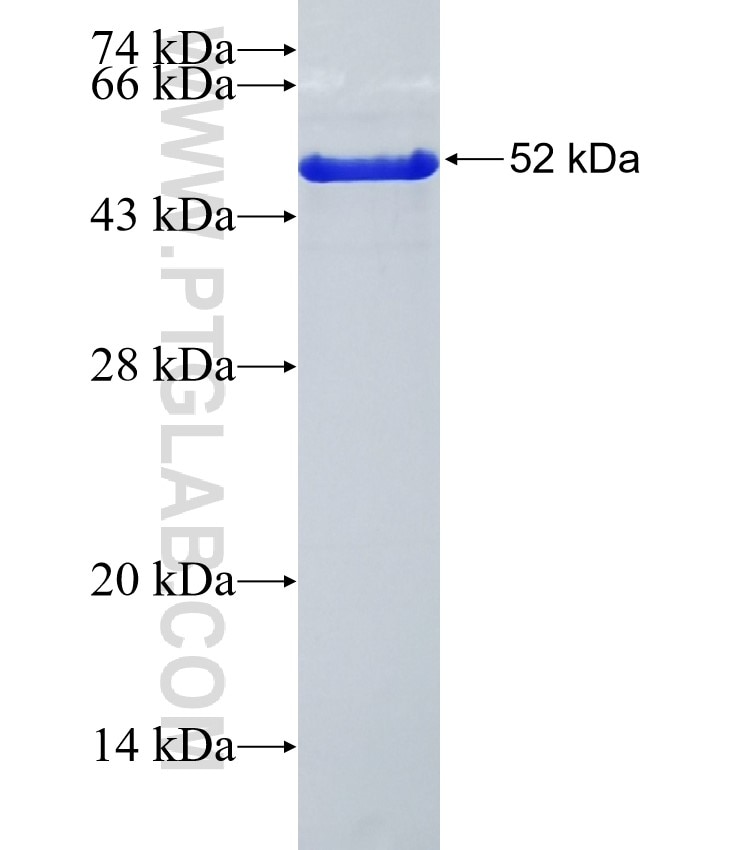 cTnT fusion protein Ag24911 SDS-PAGE