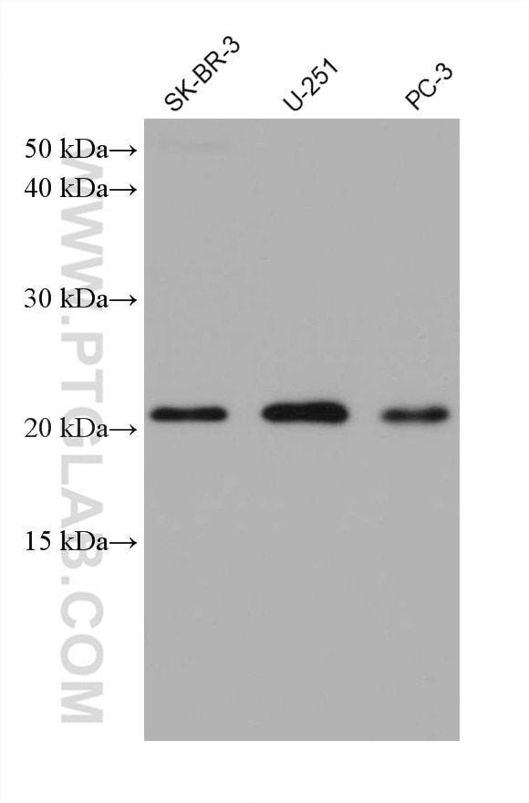 Western Blot (WB) analysis of various lysates using calcyphosine Monoclonal antibody (68225-1-Ig)