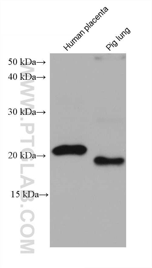 Western Blot (WB) analysis of various lysates using calcyphosine Monoclonal antibody (68225-1-Ig)