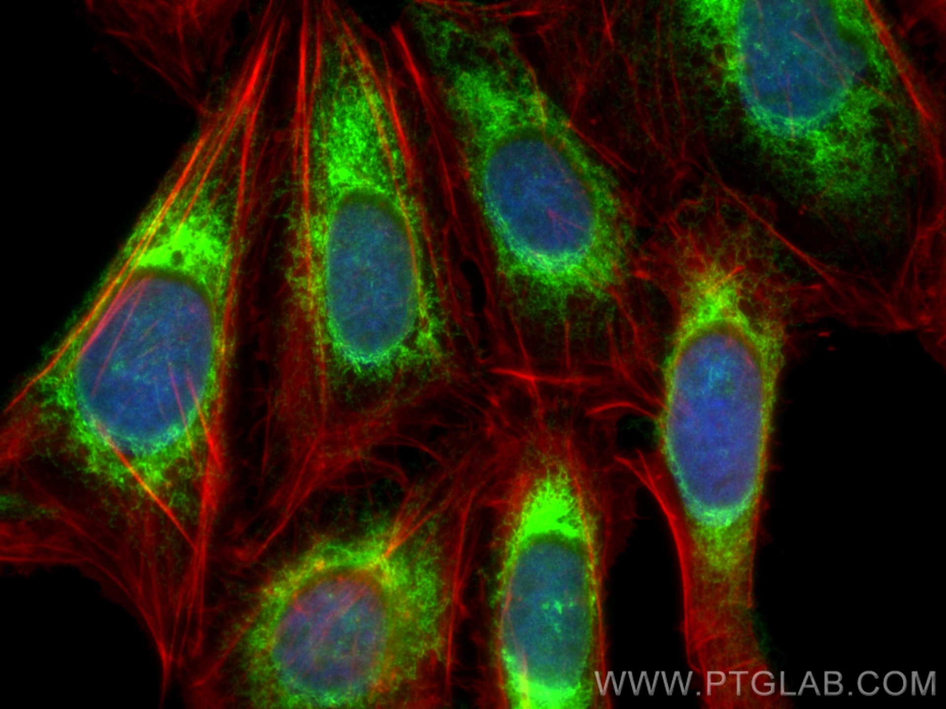 Immunofluorescence (IF) / fluorescent staining of U2OS cells using calreticulin Recombinant antibody (85593-6-RR)