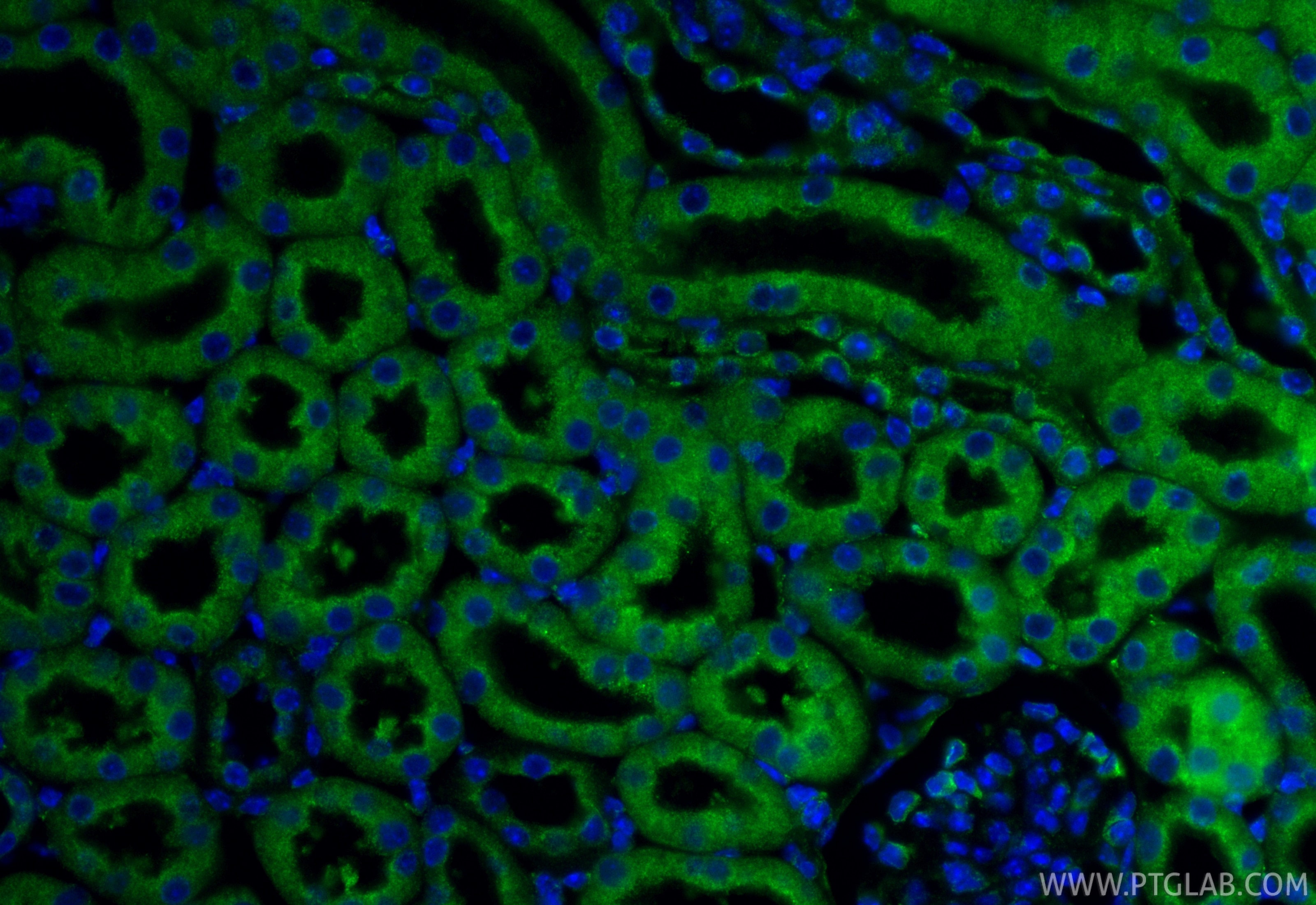 Immunofluorescence (IF) / fluorescent staining of mouse kidney tissue using calreticulin Recombinant monoclonal antibody (85593-6-RR)