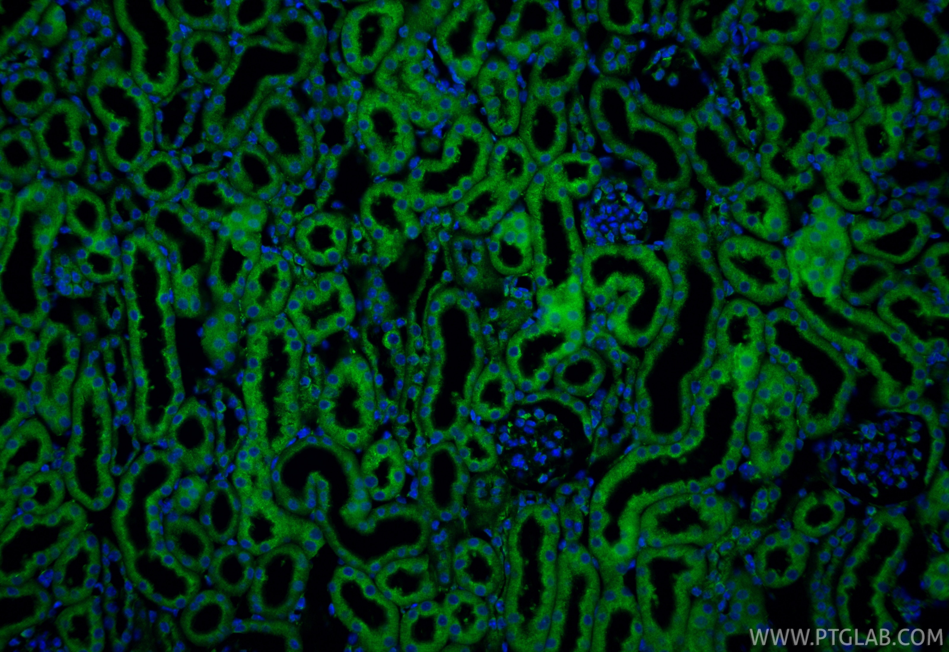 Immunofluorescence (IF) / fluorescent staining of mouse kidney tissue using calreticulin Recombinant monoclonal antibody (85593-6-RR)