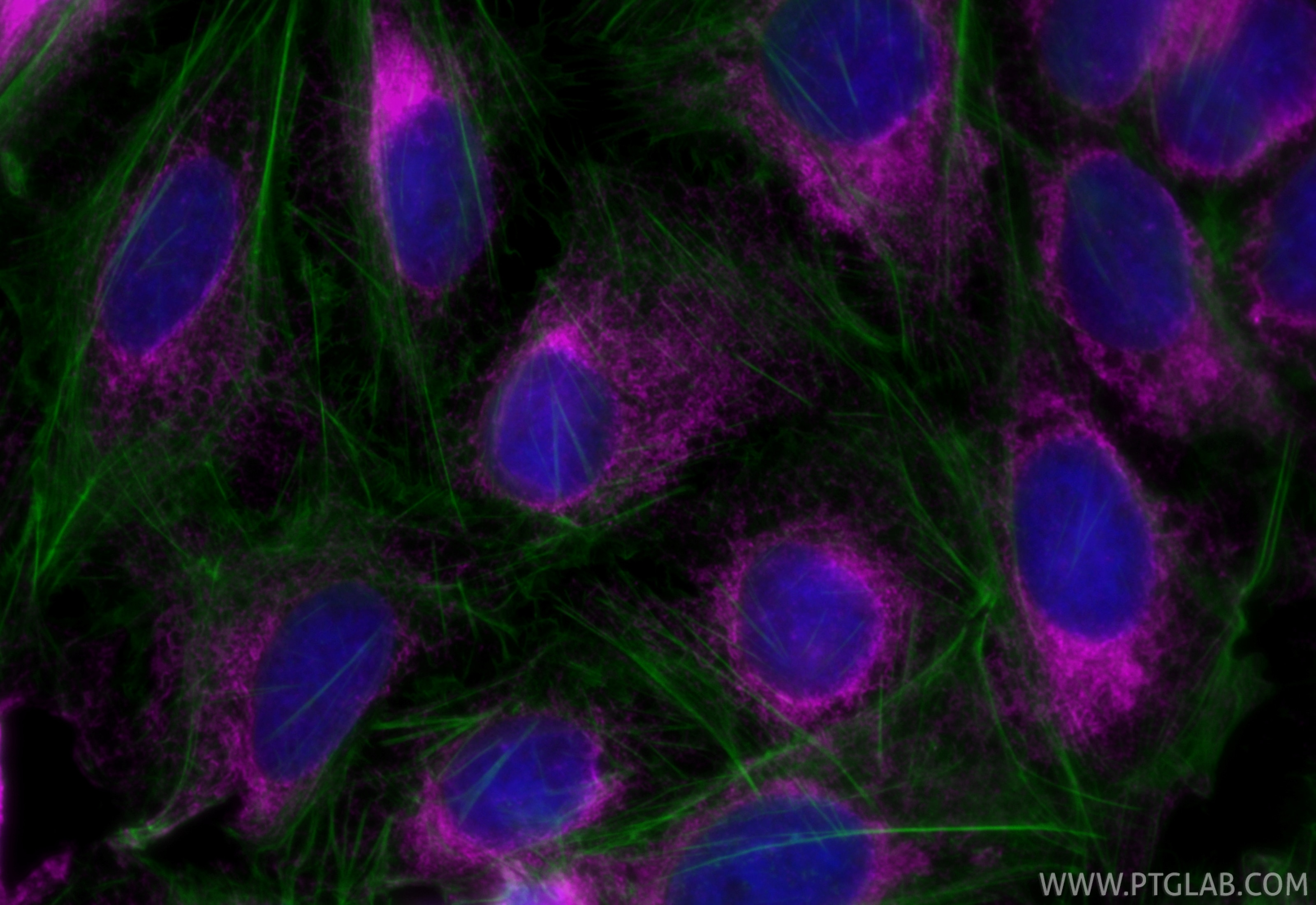 Immunofluorescence (IF) / fluorescent staining of U2OS cells using APC-conjugated calreticulin Polyclonal antibody (APC-27298)