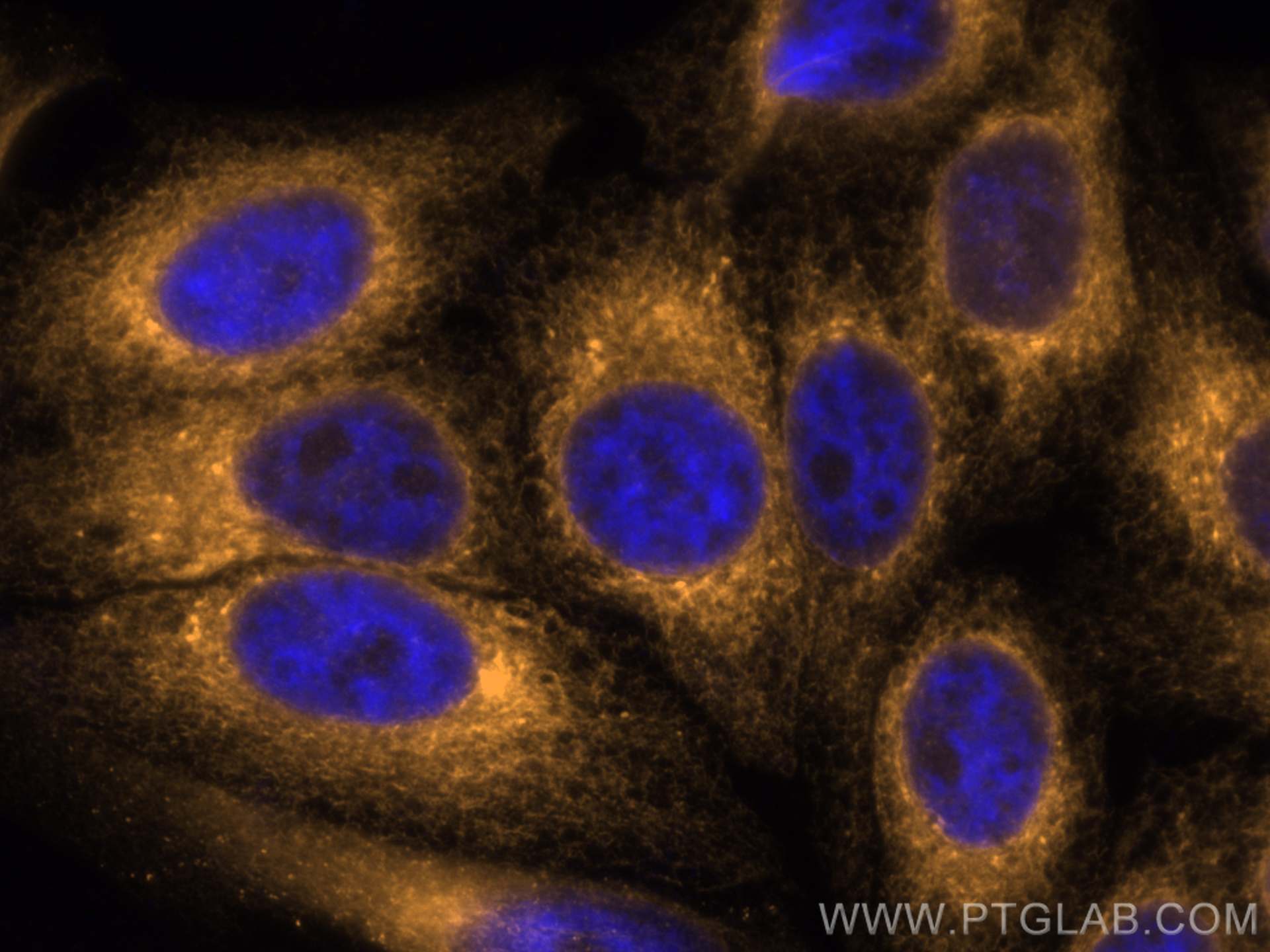 Immunofluorescence (IF) / fluorescent staining of HepG2 cells using CoraLite® Plus 555-conjugated calreticulin Polyclo (CL555-27298)