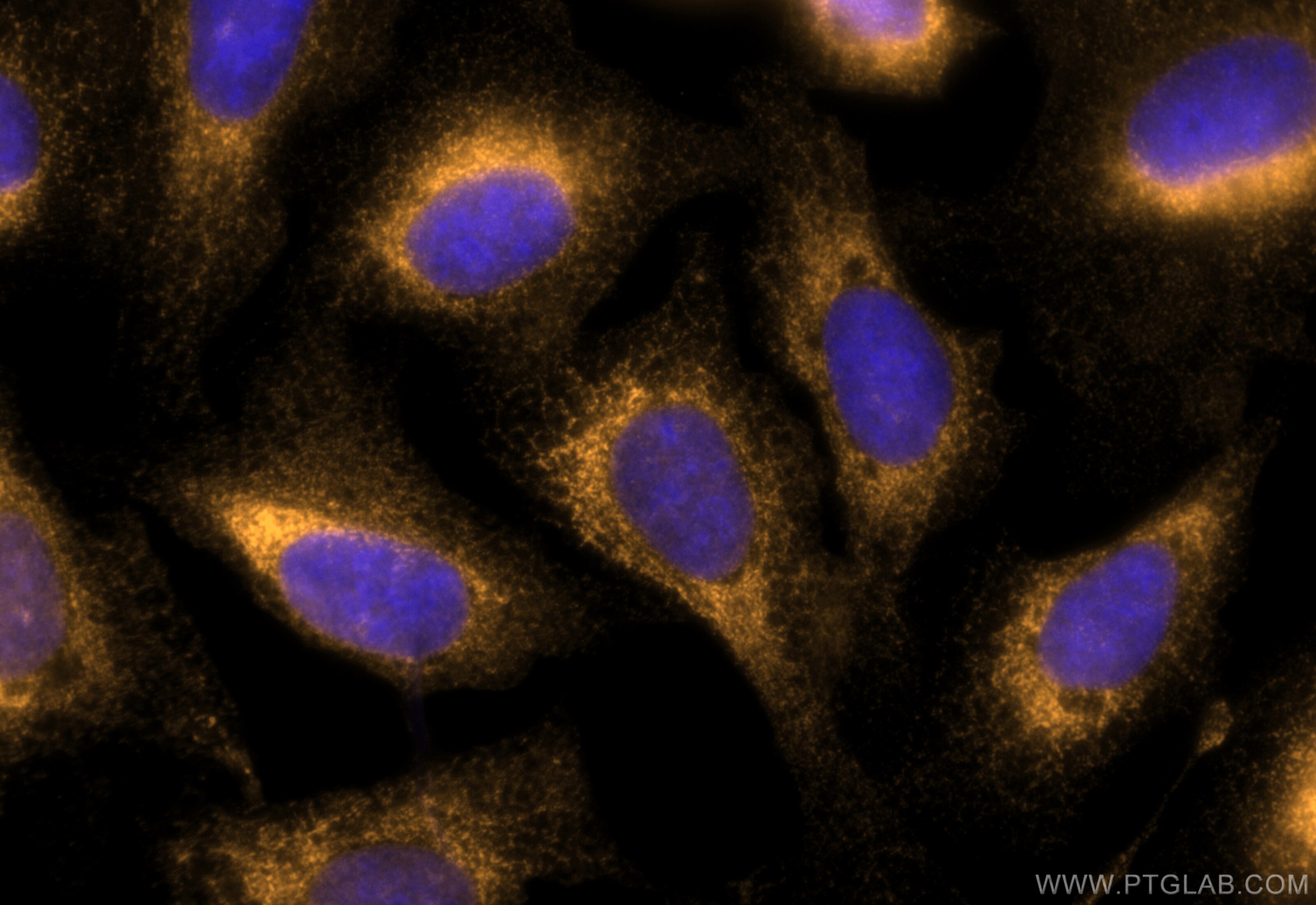 Immunofluorescence (IF) / fluorescent staining of U2OS cells using CoraLite® Plus 555-conjugated calreticulin Polyclo (CL555-27298)