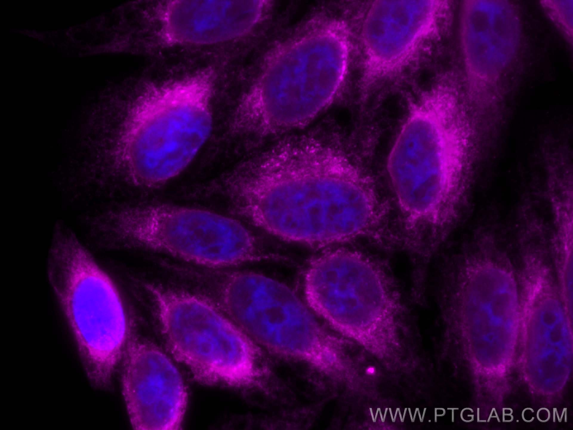 Immunofluorescence (IF) / fluorescent staining of HepG2 cells using CoraLite® Plus 647-conjugated calreticulin Polyclo (CL647-27298)