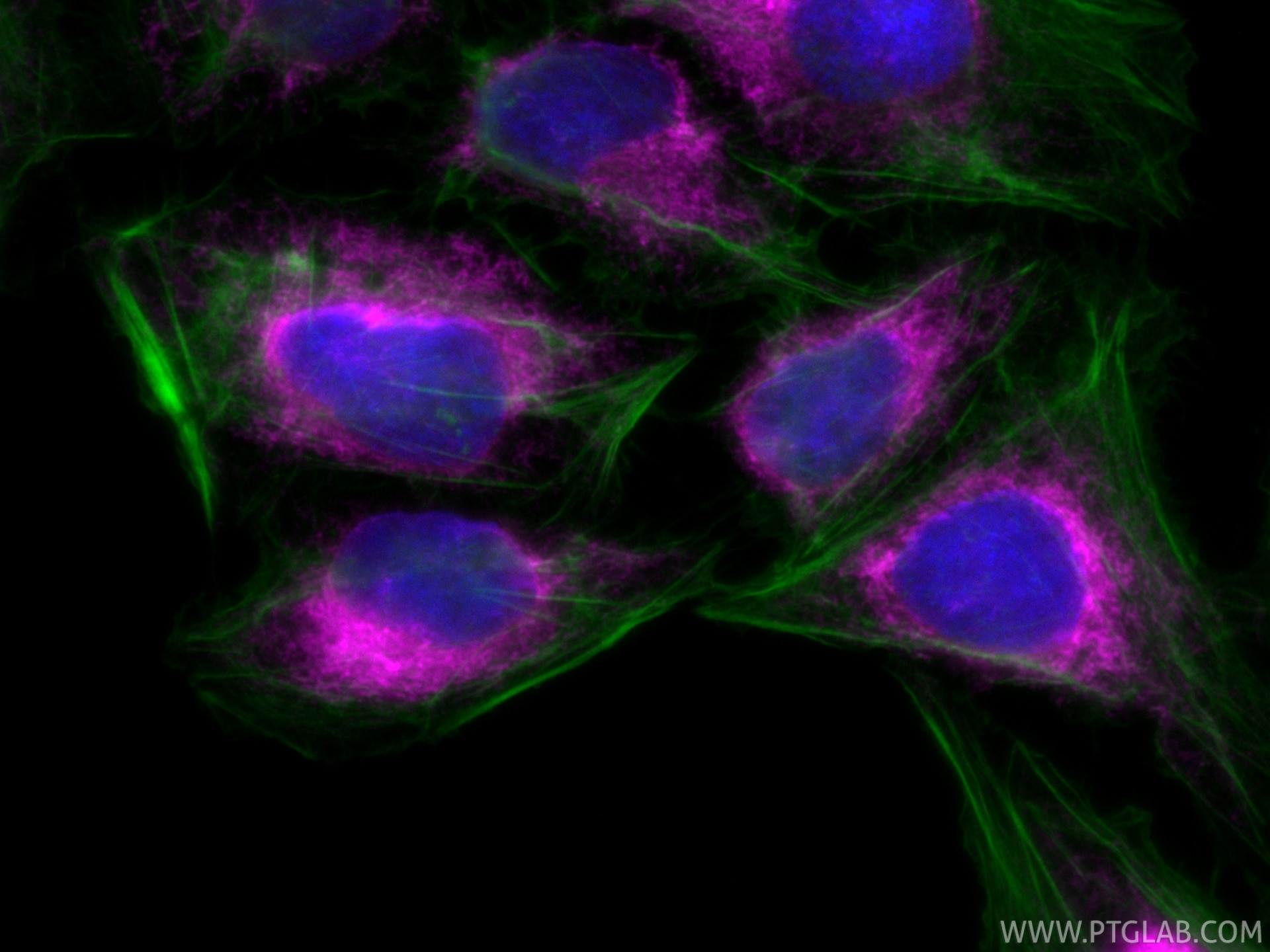 Immunofluorescence (IF) / fluorescent staining of U2OS cells using CoraLite® Plus 647-conjugated calreticulin Recombi (CL647-85593-6)