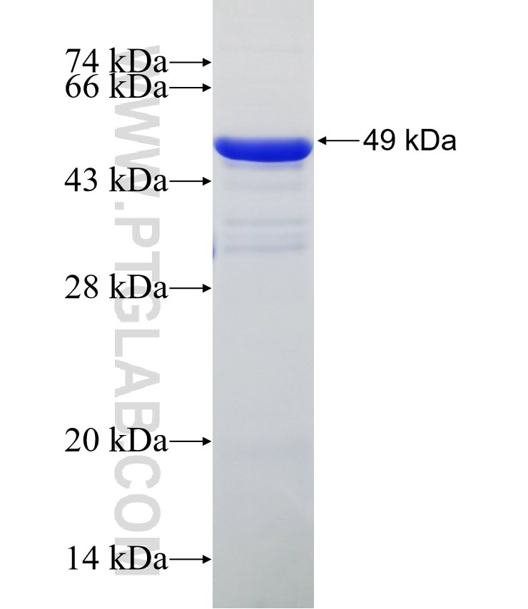 calreticulin fusion protein Ag26064 SDS-PAGE
