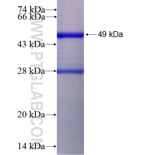 calreticulin fusion protein Ag0325 SDS-PAGE