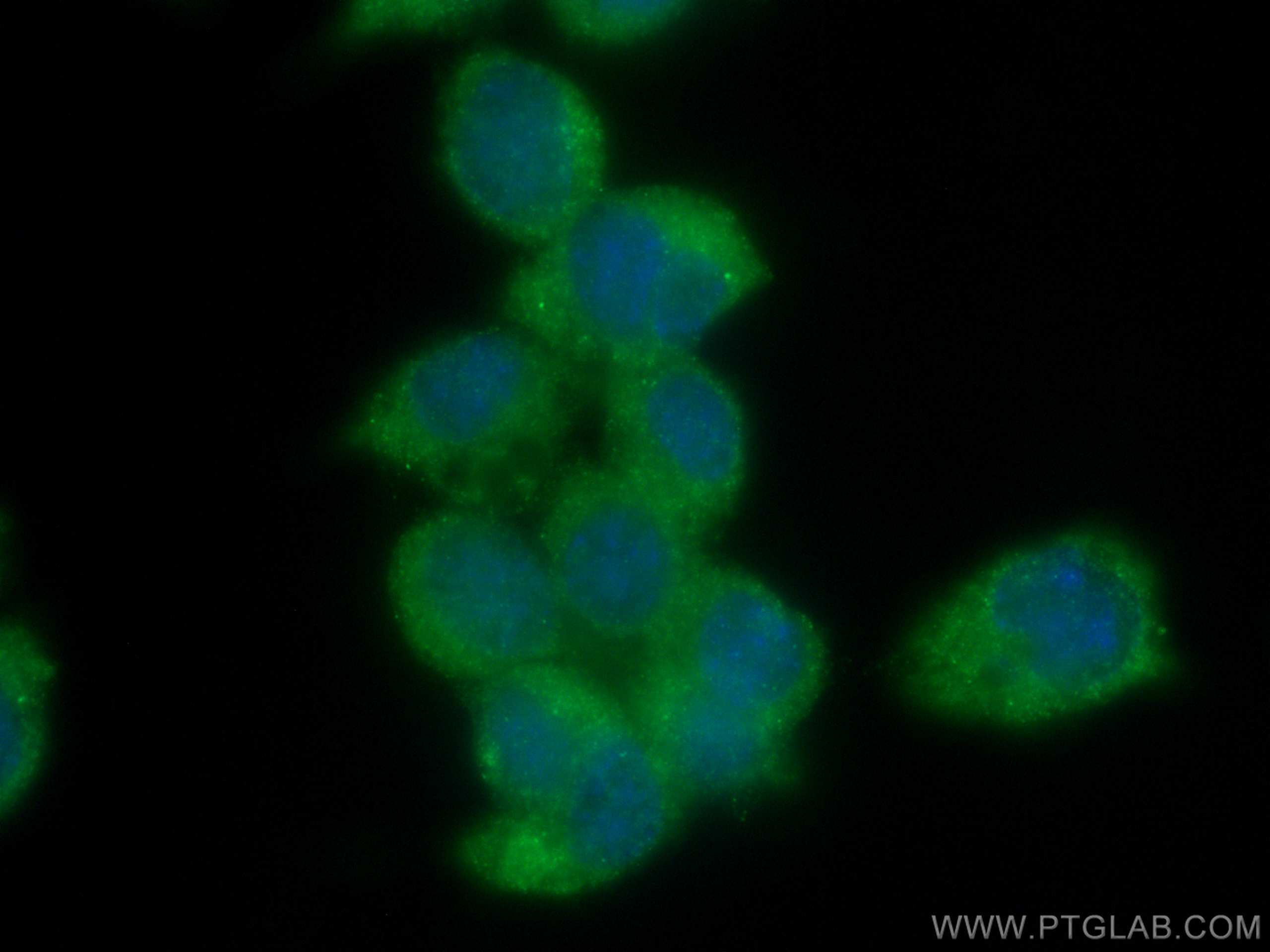 Immunofluorescence (IF) / fluorescent staining of Neuro-2a cells using Chromogranin A Monoclonal antibody (60135-2-Ig)
