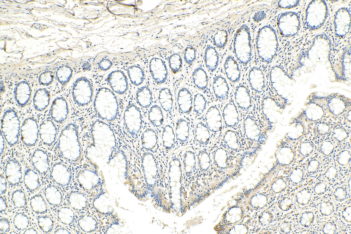 Immunohistochemistry (IHC) staining of human colon tissue using Chromogranin A Monoclonal antibody (60135-2-Ig)