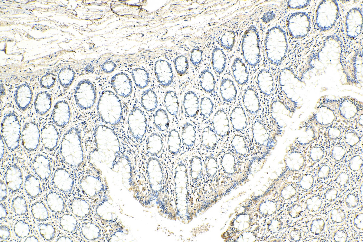 IHC staining of human colon using 60135-2-Ig