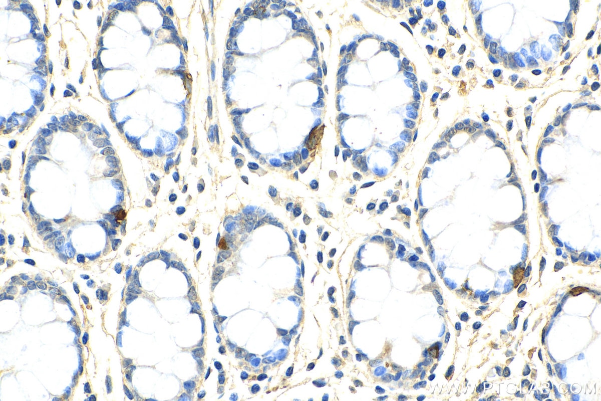 Immunohistochemistry (IHC) staining of human colon tissue using Chromogranin A Monoclonal antibody (60135-2-Ig)