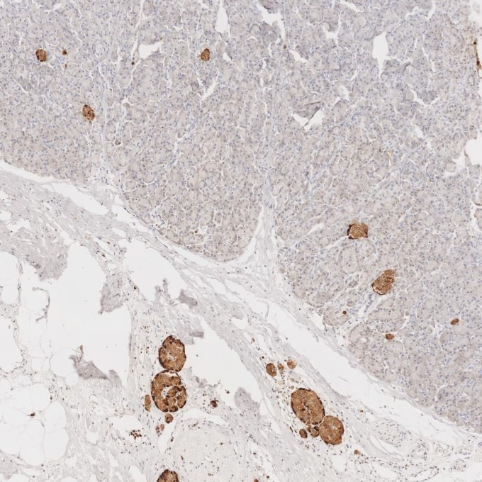 IHC staining of human pancreas using 60135-2-Ig Immunohistochemistry (IHC) staining of human pancreas tissue using Chromogranin A Monoclonal antibody (60135-2-Ig)