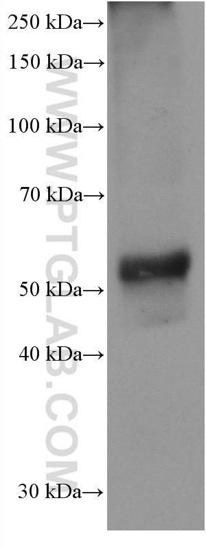 WB analysis of mouse pancreas using 60135-2-Ig