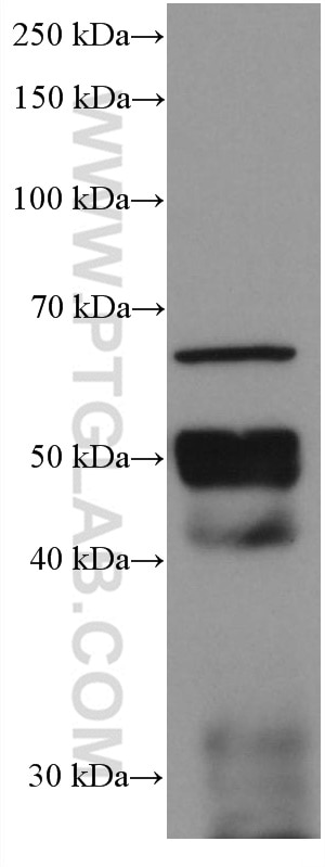 Western Blot (WB) analysis of pig pancreas tissue using Chromogranin A Monoclonal antibody (60135-2-Ig)