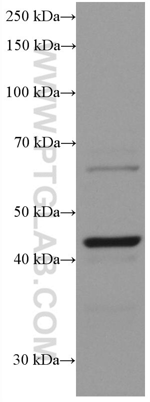 WB analysis of SH-SY5Y using 60135-2-Ig