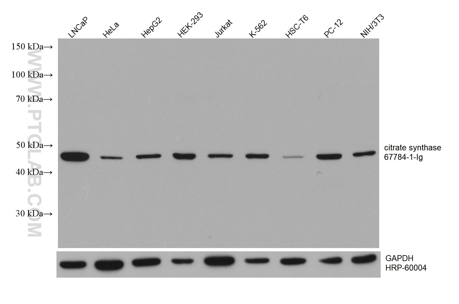 Western Blot (WB) analysis of LNCaP cells using citrate synthase Monoclonal antibody (67784-1-Ig)