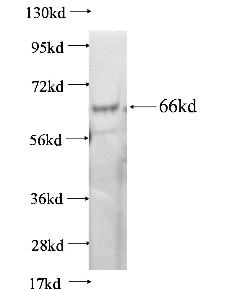 cka1 fusion protein Ag0722 SDS-PAGE