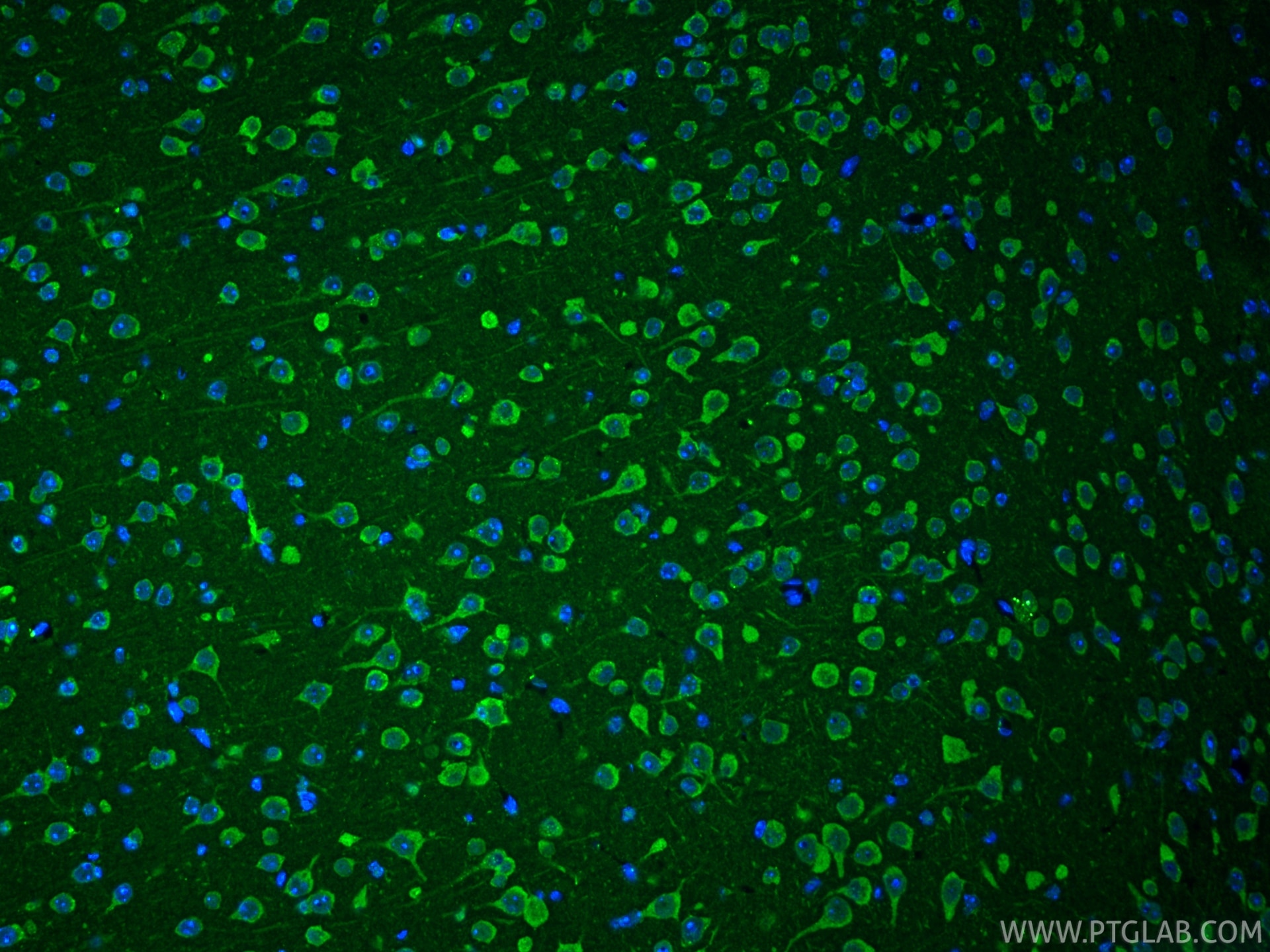 IF Staining of mouse brain using 25128-1-AP Immunofluorescence (IF) / fluorescent staining of mouse brain tissue using Cleaved Caspase 3 Polyclonal antibody (25128-1-AP)
