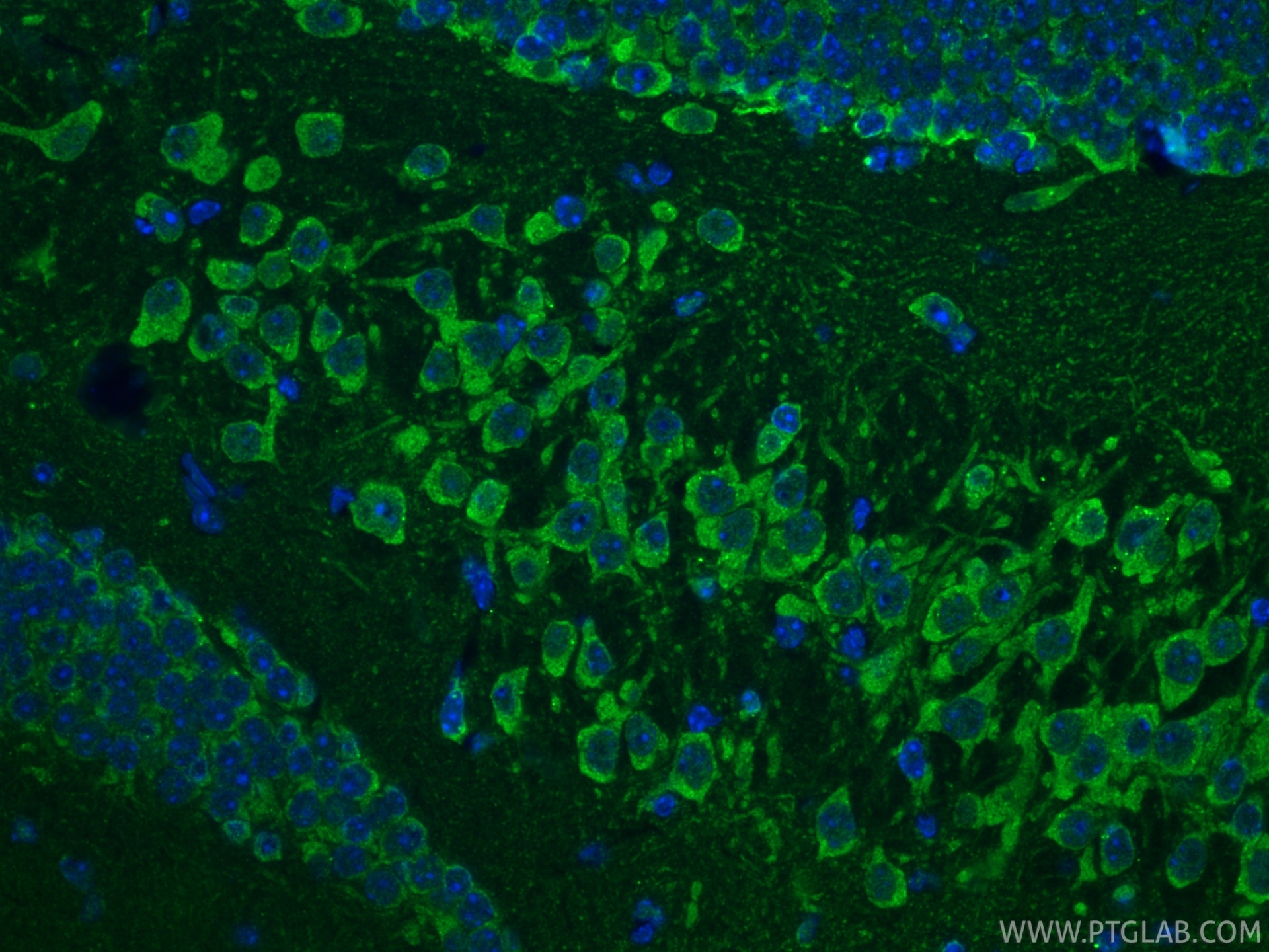 IF Staining of mouse brain using 25128-1-AP Immunofluorescence (IF) / fluorescent staining of mouse brain tissue using Cleaved Caspase 3 Polyclonal antibody (25128-1-AP)