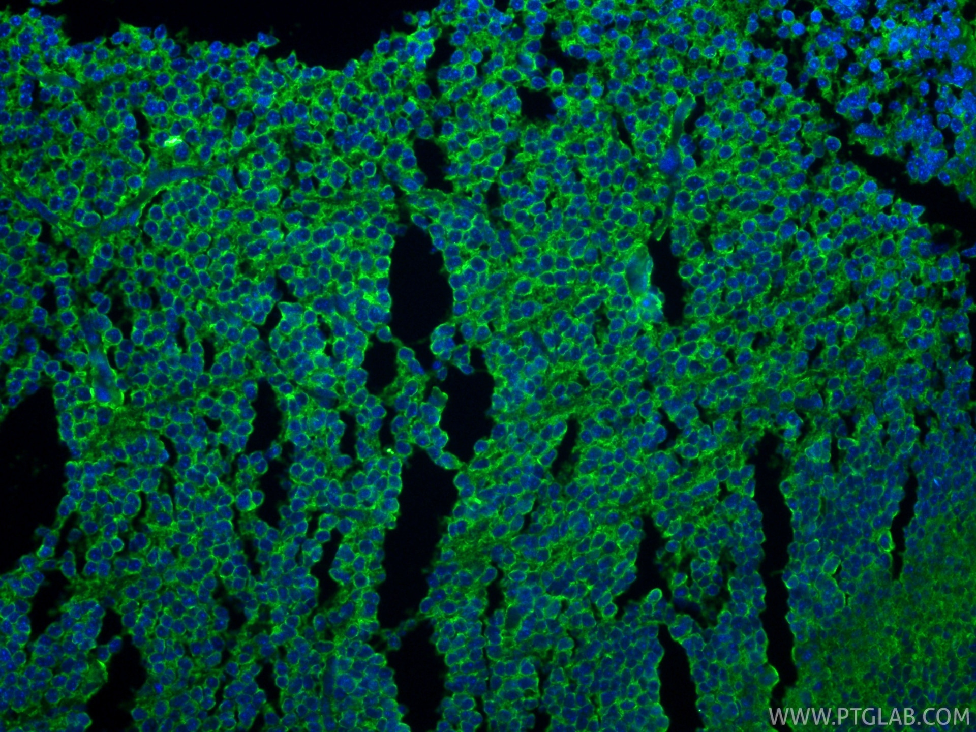 IF Staining of mouse embryo using 25128-1-AP Immunofluorescence (IF) / fluorescent staining of mouse embryo tissue using Cleaved Caspase 3 Polyclonal antibody (25128-1-AP)