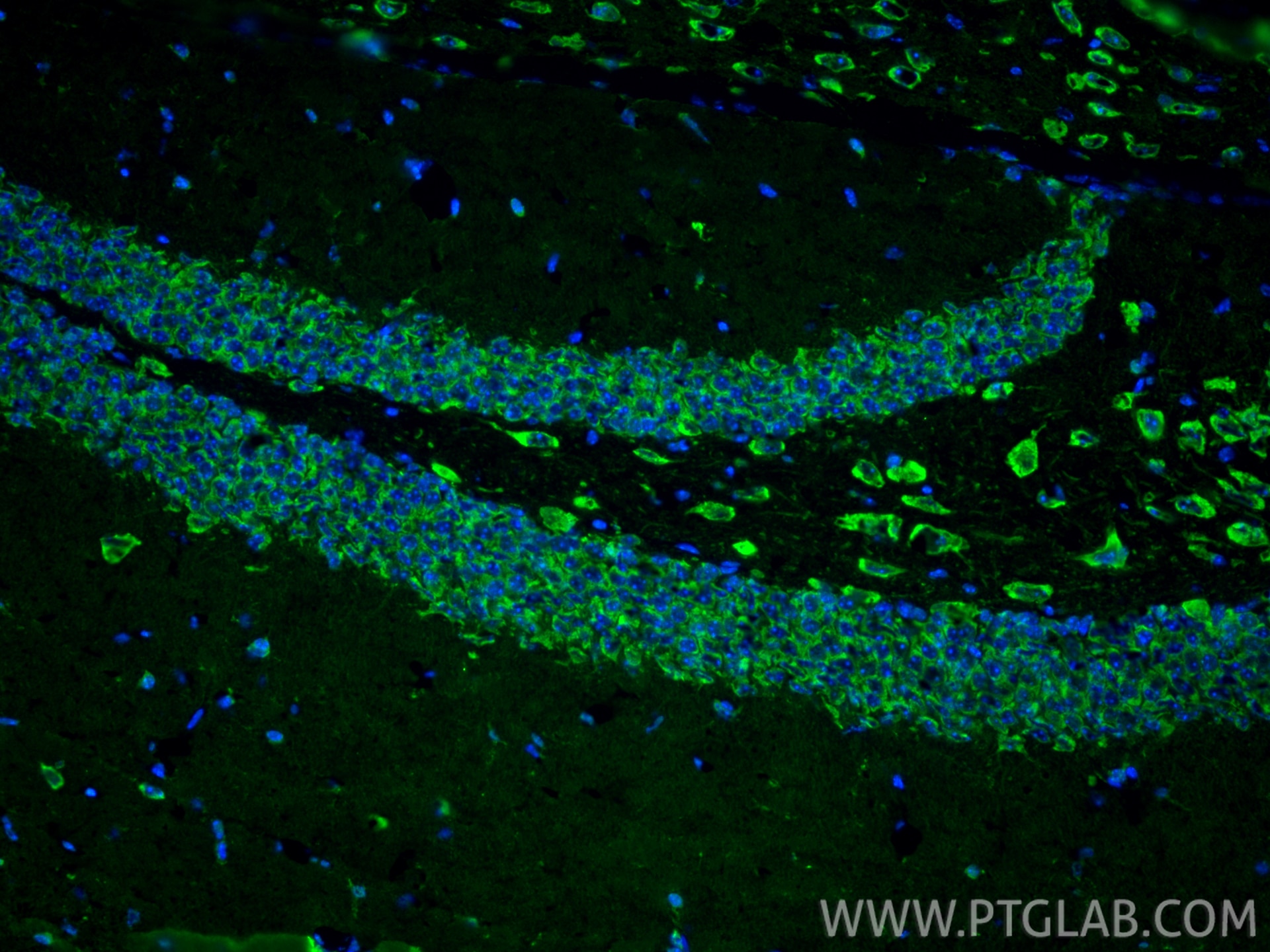 IF Staining of mouse brain using 25128-1-AP Immunofluorescence (IF) / fluorescent staining of mouse brain tissue using Cleaved Caspase 3 Polyclonal antibody (25128-1-AP)