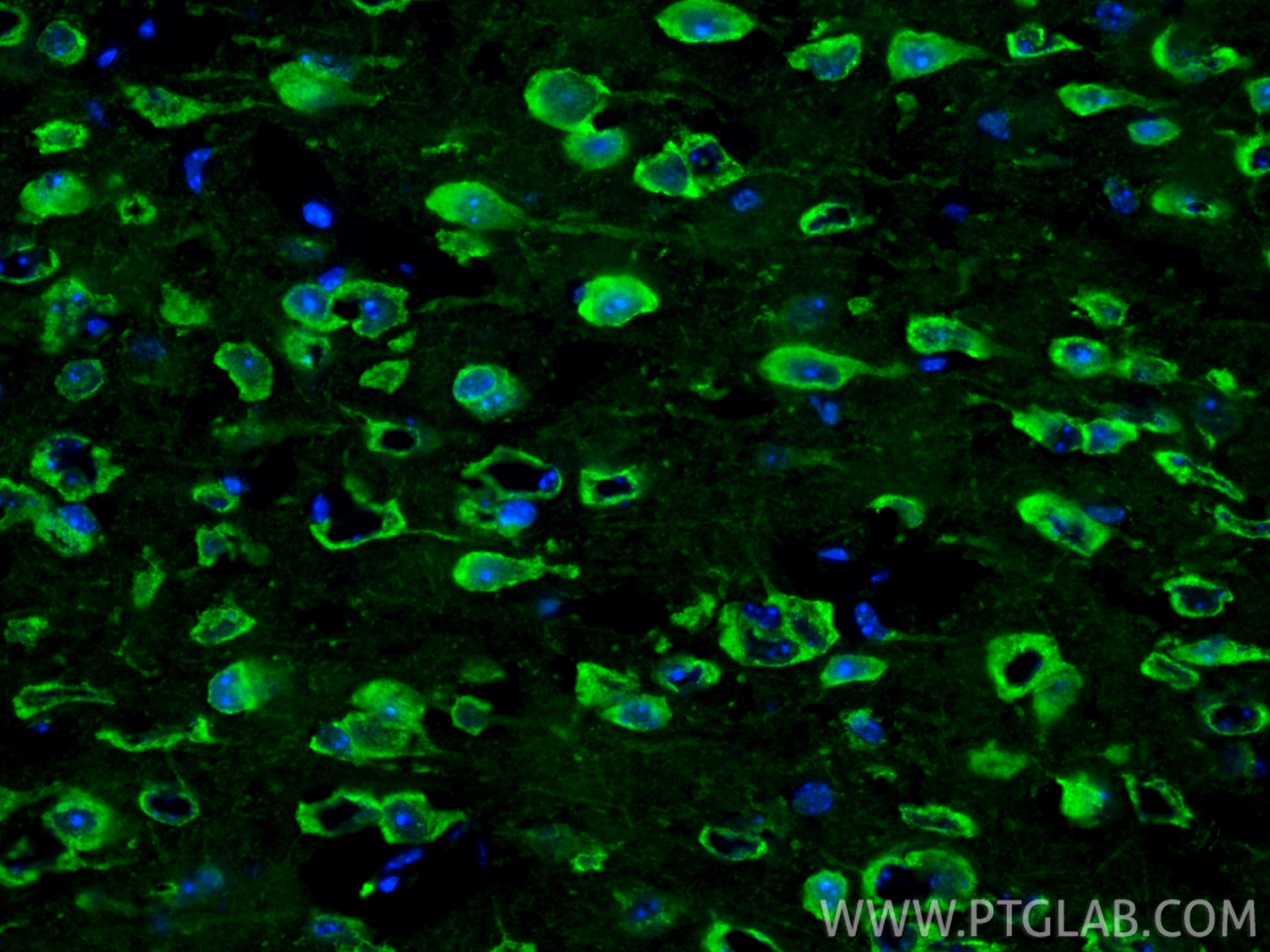 IF Staining of mouse brain using 25128-1-AP Immunofluorescence (IF) / fluorescent staining of mouse brain tissue using Cleaved Caspase 3 Polyclonal antibody (25128-1-AP)