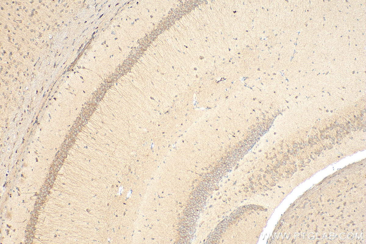 Immunohistochemistry (IHC) staining of mouse brain tissue using Cleaved Caspase 3 Polyclonal antibody (25128-1-AP)