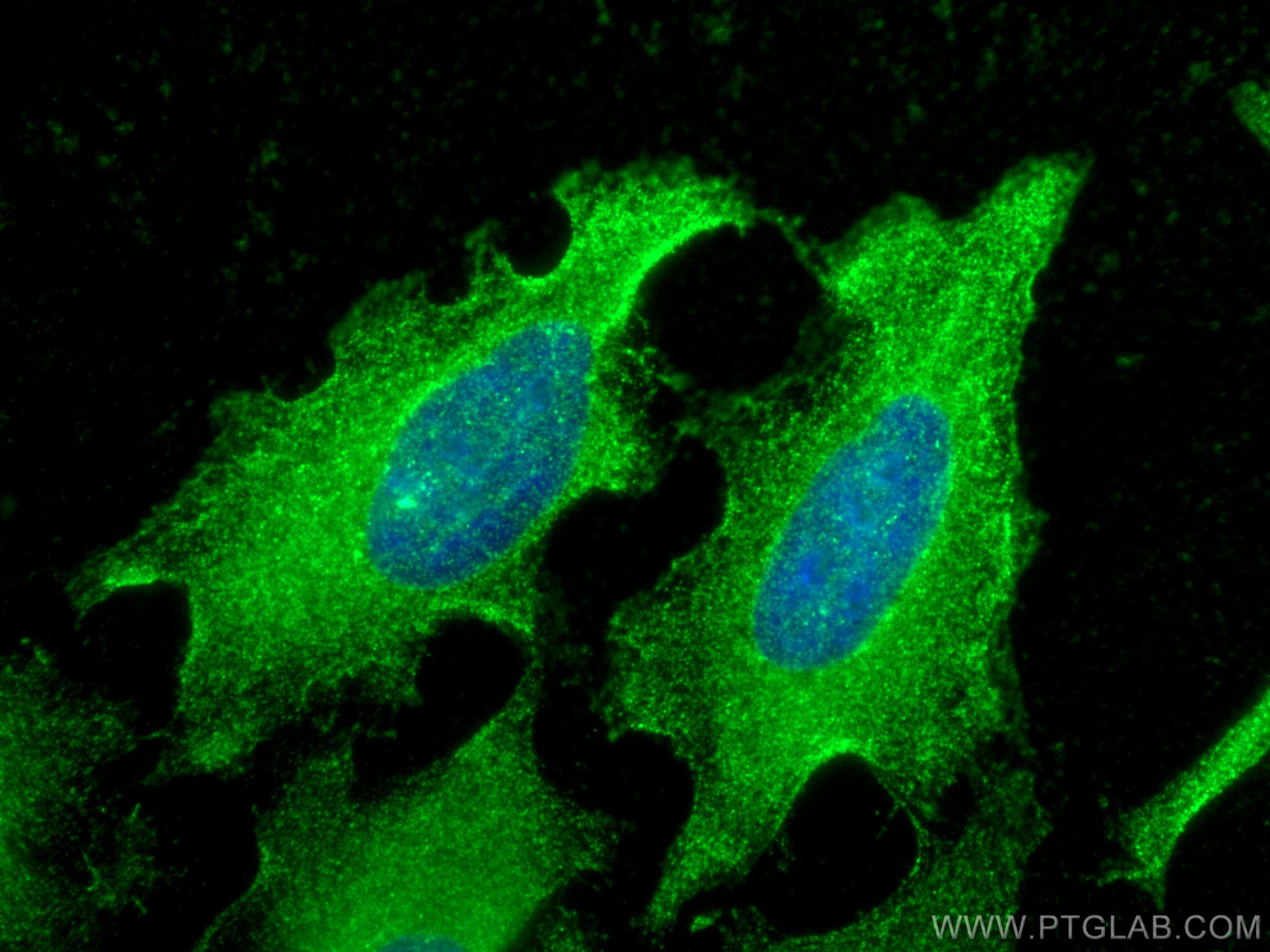 Immunofluorescence (IF) / fluorescent staining of HeLa cells using cyclin B1 Monoclonal antibody (67686-1-Ig)