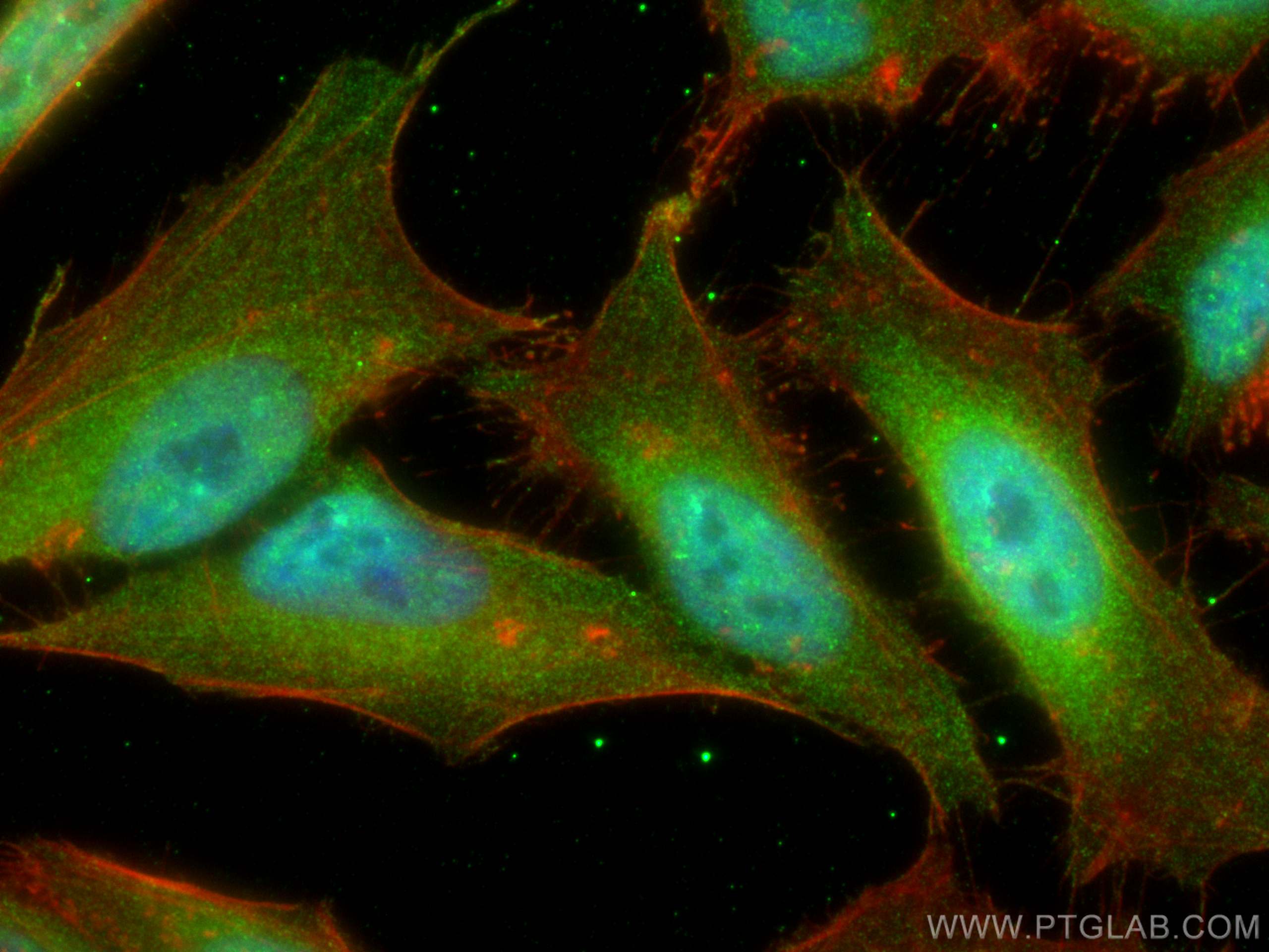 Immunofluorescence (IF) / fluorescent staining of HeLa cells using cyclin B1 Monoclonal antibody (67686-1-Ig)