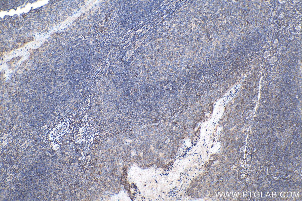 Immunohistochemistry (IHC) staining of human tonsillitis tissue using cyclin B1 Monoclonal antibody (67686-1-Ig)