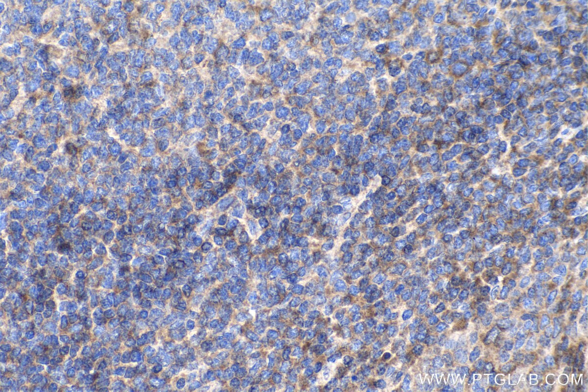 Immunohistochemistry (IHC) staining of human tonsillitis tissue using cyclin B1 Monoclonal antibody (67686-1-Ig)